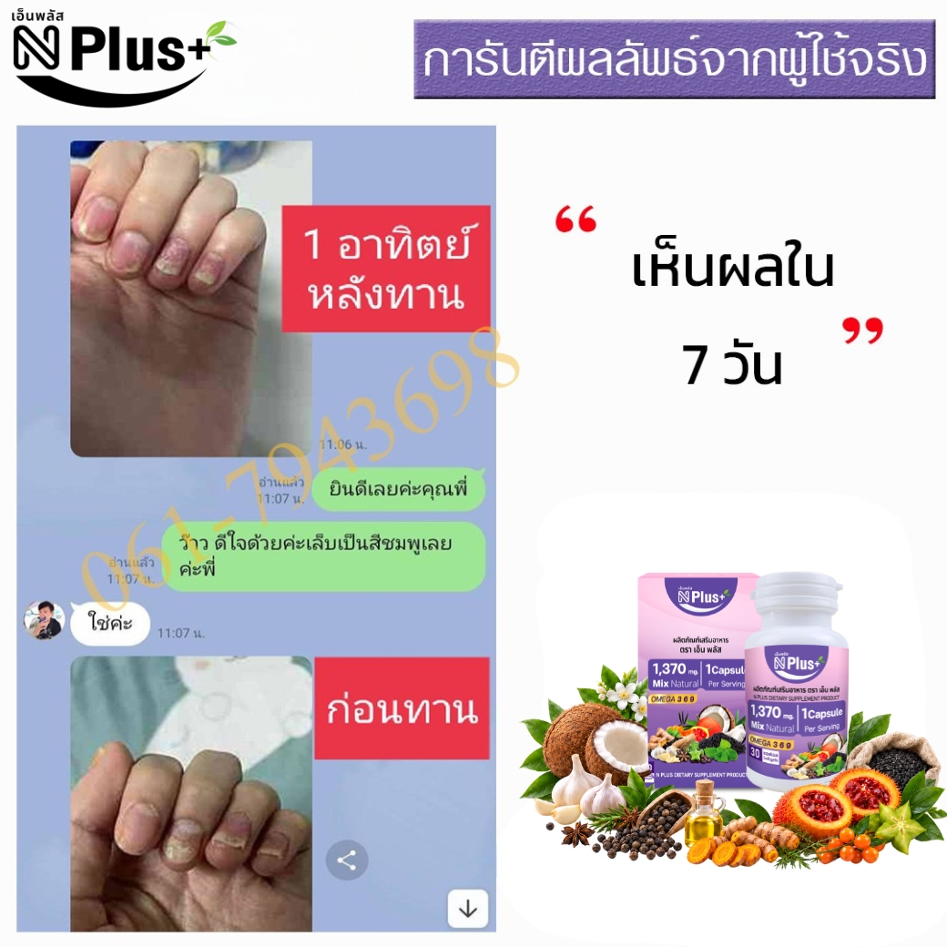 SK (3)